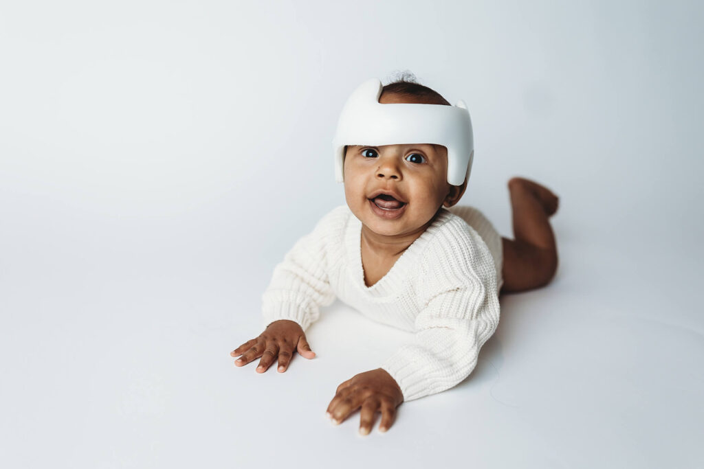 Smiling baby wearing a cranial helmet from Cranial Technologies, photographed in a studio